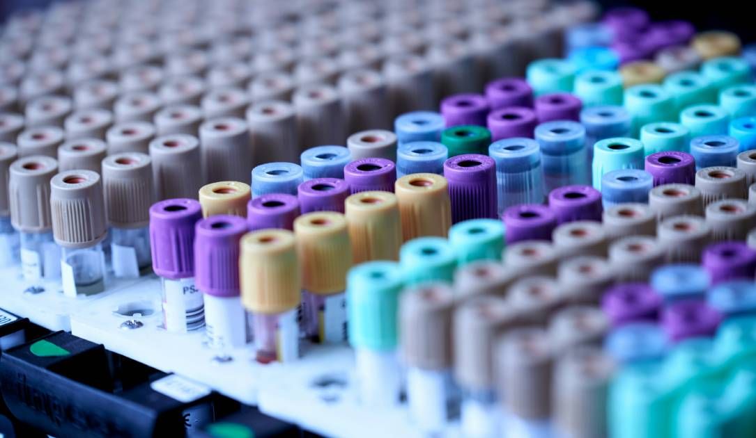 Labcorp revisará sus prácticas de seguridad de datos y pagará una multa de 2,3 millones de dólares por fallos en la ciberseguridad
